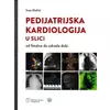 Pedijatrijska kardiologija u slici od fetalne do odrasle dobi