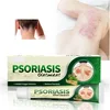 Prirodna mast za psorijazu