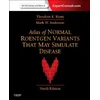 Atlas of Normal Roentgen Variants That May Simulate Disease
