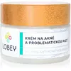 Lobey Skin Care krema za aknasto kožo 50 ml