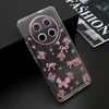 Futrola whisper za honor x9c/magic 7 lite roze ( F123957 )