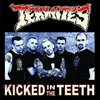 The Termites - Kicked In The Teeth (Limited Edition) (LP)