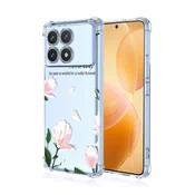 Prozoren ovitek “Wildflower” za Xiaomi Poco X6 Pro/Redmi K70E