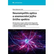 Neuromyelitis optica a poruchy jejího širšího spektra