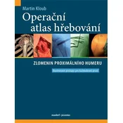 Operační atlas hřebování zlomenin proximálního humeru