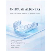 Inhouse aligner