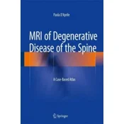 MRI of Degenerative Disease of the Spine