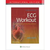 ECG Workout