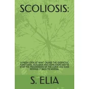 Scoliosis: : A Fresh Look at What Causes the Idiopathic Functional Scoliosis and Home Exercises to Stop the Progression of the Cu