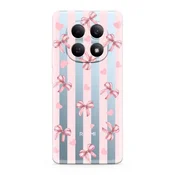 Futrola ultra tanki print clear za xiaomi redmi note 15 5g sp006 ( F124931 )