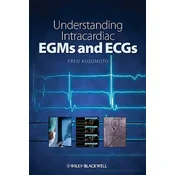 Understanding Intracardiac EGMs and ECGs