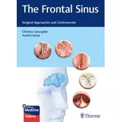 The Frontal Sinus