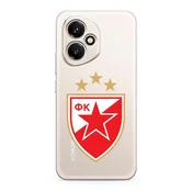 Futrola ultra tanki print clear za honor 400 zf004 ( F124451 )