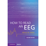 How to Read an EEG