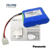 TELIT POWER Edan HYLB-102 Li-ion paket 14/4 V 3400 mAh