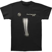 Foo Fighters X-Ray Black XL Majica
