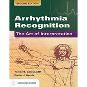 Arrhythmia Recognition: The Art Of Interpretation