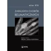 Atlas RTG zapalnych chorób reumatycznych
