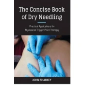 Concise Book of Dry Needling