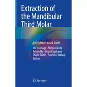Extraction of the Mandibular Third Molar