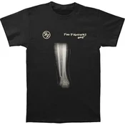 Foo Fighters X-Ray Black M Majica