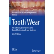 Tooth Wear