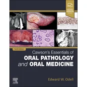 Cawsons Essentials of Oral Pathology and Oral Medicine