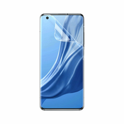 Baseus 0,15 mm zaščitna folija za zaslon 2 kom za Xiaomi Mi 11