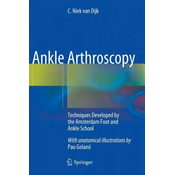 Ankle Arthroscopy