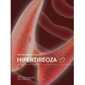 Hipertireoza