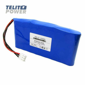 TelitPower baterija Li-Ion 14.4V 5700mAh LG za EKG monitor Comen CM1200A ( P-2216 )