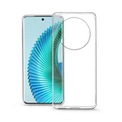 shumee Tanek ovitek za Xiaomi Redmi A3 4G, prozoren, brezbarven, zadaj + steklo