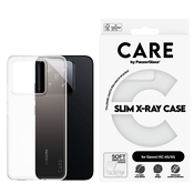 Ovitek X-Ray za Xiaomi 15C 5G, Prozorna, PanzerGlass