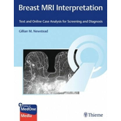 Breast MRI Interpretation