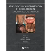 Atlas of Clinical Dermatology in Coloured Skin