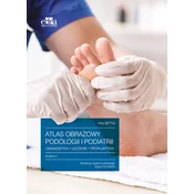 Atlas obrazowy podologii i podiatrii Diagnostyka, leczenie, profilaktyka