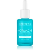Dermedic Normacne serum za obraz proti aknam 30 ml