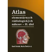 Atlas elementárnych rádiologických nálezov - II. diel