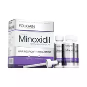 Minoksidil 2 % serum za ženske, 180 ml