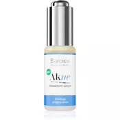 Saloos Bio Acne Bioactive Serum 20ml