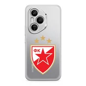 Futrola ultra tanki print clear za honor 400 pro zf004 ( F124455 )
