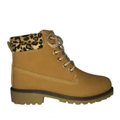 Gležnarji In leopard