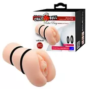 Veštacka vagina