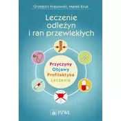 Leczenie odlezyn i ran przewleklych