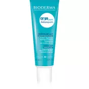 BIODERMA ABC Derm Babysquam krema za otroke proti prhljaju 40 ml