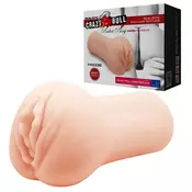 Veštacka vagina