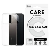 Ovitek X-Ray za Xiaomi 15 Pro, Prozorna, PanzerGlass