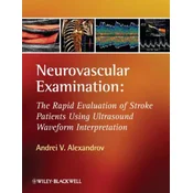 Neurovascular Examination - The Rapid Evaluation of Stroke Patients Using Ultrasound Waveform Interpretation