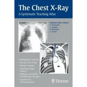The Chest X-Ray