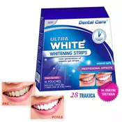 ULTRA WHITE Trake za izbeljivanje zuba – 14 dana